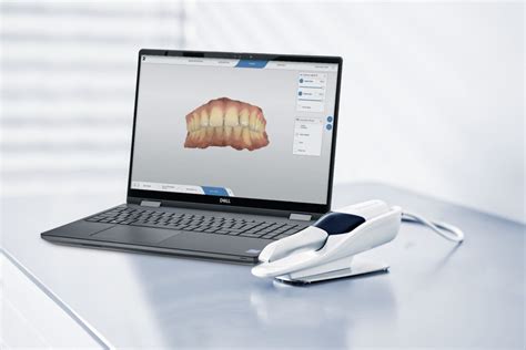 Primescan Connect Jacobsen Dental