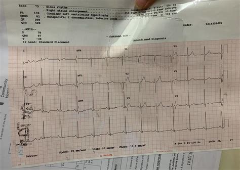 Abnormal ecg - help : r/ReadMyECG