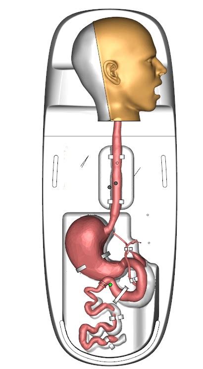 经内镜逆行胰胆管造影术（ercp）模型 宁波创导三维医疗科技有限公司 血管介入模型 内窥镜