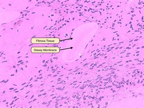 Atretic Follicle Histology Slides Female Reproductive System Cell