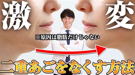 【二重あご解消】二重あごをなくす方法！※原因は脂肪だけじゃありません Youtube