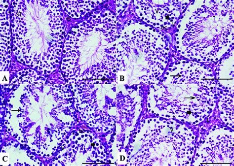 Photomicrograph Of Sections From Testis Control A And Treated Mice