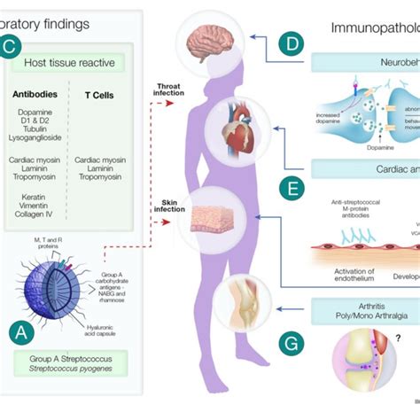 Clinical And Immunopathological Features Of Acute Rheumatic Fever And Download Scientific