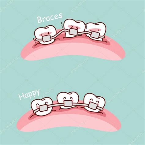 Descargar Cute Dibujos Animados Dientes Brackets — Ilustración De