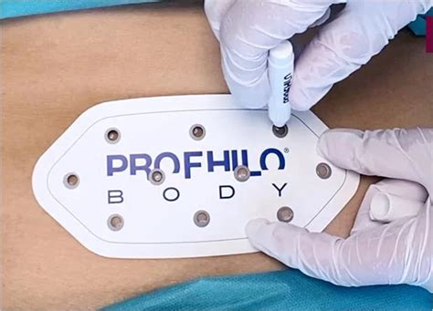 Profhilo Body Treatment In Malaysia Nextmed Clinic