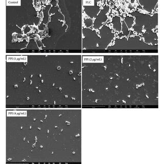 Effect Of Ppi Or Flc On The Morphological Changes Of C Albicans In