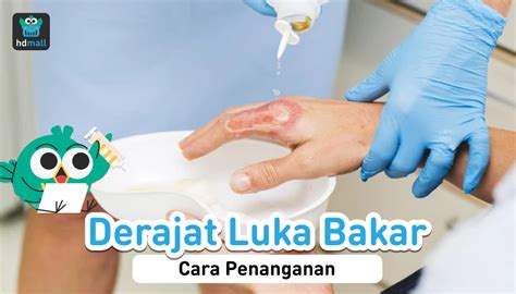 Derajat Luka Bakar Cara Menghitung Dan Penanganannya Hdmall