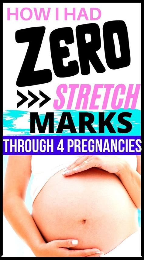 How To Prevent Stretch Marks During Pregnancy Artofit