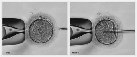 Intra Cytoplasmic Sperm Injection Icsi Factsheet