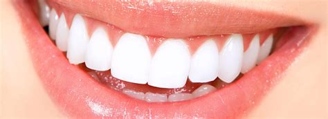 All to know about Teeth Veneers | Healing Clinic Turkey