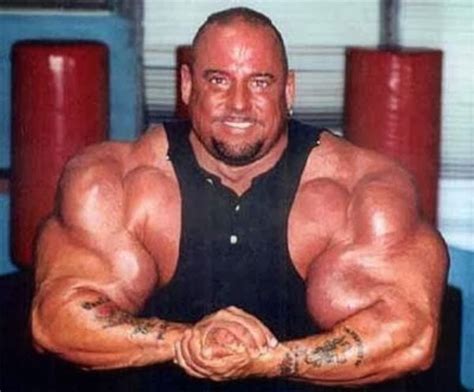 Noticias Del Mundo Los Terribles Efectos Del Synthol En Los Culturistas