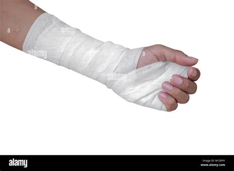 Gauze Bandage Patient With Hand Wrap Injury Isolated On White