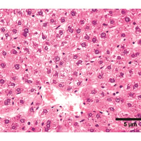 Photomicrographs Of Liver Sections Stained With Hematoxylin And Eosin