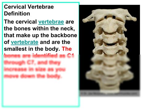 Solution Cervical Vertebrae Anatomy And Articulations Studypool