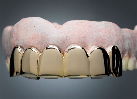 Are Dental Grills Safe Reliable Criteria To Consider