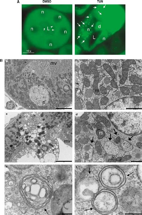 Er Stress Induces Hallmarks Of Apoptosis And Autophagy In Vivo In The