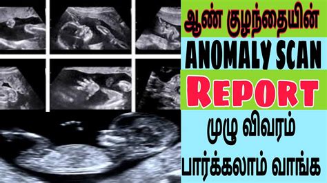 Boy Baby Anomaly Scan Report In Tamil Month Anomaly Scan Boy Baby