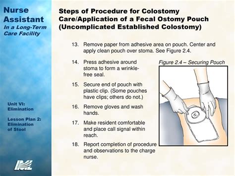 Colostomy Procedure Steps