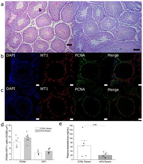 Metabolites Free Full Text Paternal Obesity Induced By High Fat