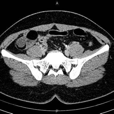 Radiology Quiz 83131 Radiopaedia Org