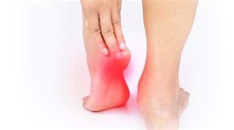 Plantar Fasciitis Treatment Treatment In Chelmsford Forte Physical Health