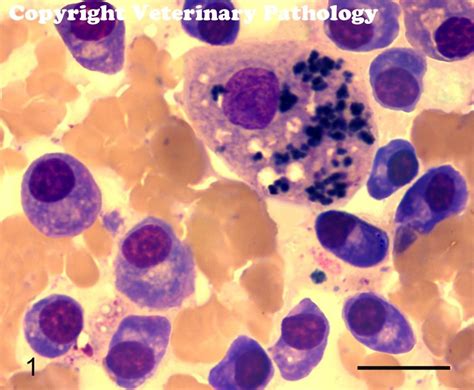 Plasma Cells