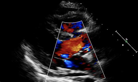 Principles Of Hemodynamics The Cardiovascular