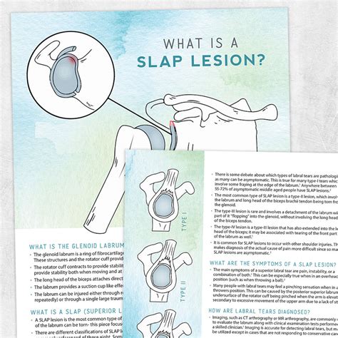 SLAP Lesions – Adult and pediatric printable resources for speech and ...