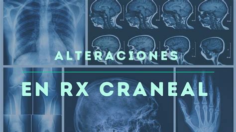 Alteraciones en radiografía Queli Mora uDocz