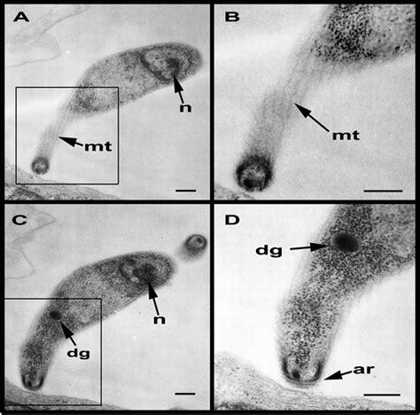 Distribution Of Cryptosporidium Parvum Sporozoite Apical Organelles