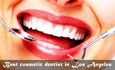 13 Best Cosmetic Dentists Los Angeles Dental Veneers 2024