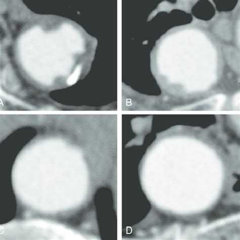 Examples Of Multiplanar Reconstruction Computed Tomography Images Download Scientific Diagram