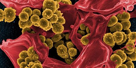 How Do Superbugs Become Super Understanding Antibiotic Resistance