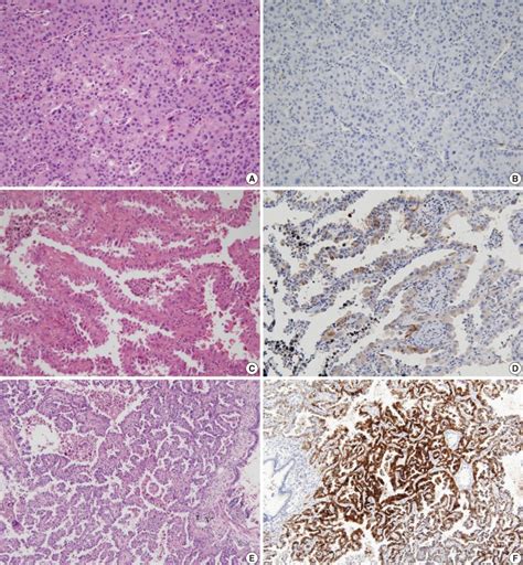 Immunohistochemical Findings Of Naked Cuticle Drosophila Nkd In