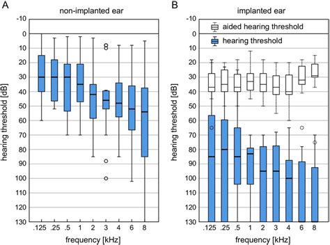 Boxplot Representation Of The Preoperatively Determined Pure Tone