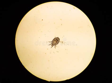 Ear Mite Egg From A Cat Under The Microscope Stock Image Image Of Mite Life 193226445