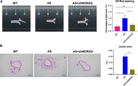 Frontiers LncRNA NORAD Promotes Vascular Endothelial Cell Injury And