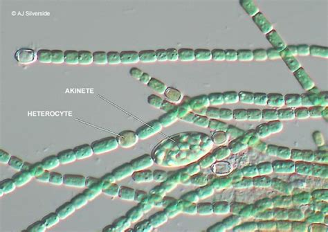 Anabaena Under Microscope Labeled