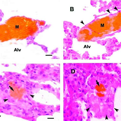 Grades of meconium staining in the skin of piglets. A , mild; B ...