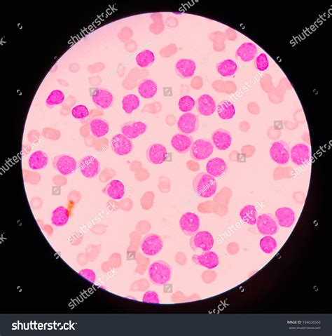 Blood Smear Under Microscope Stock Photo 194026565 | Shutterstock