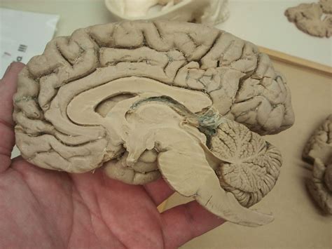 Sagittal Section Of The Human Brain