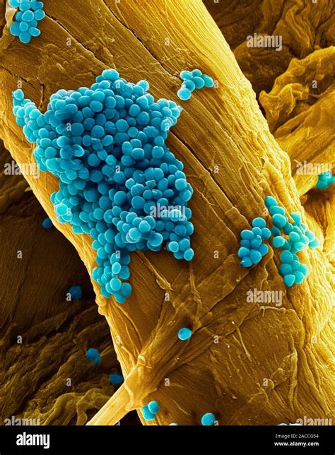 Streptococcus Pneumoniae Coloured Scanning Electron Micrograph Sem