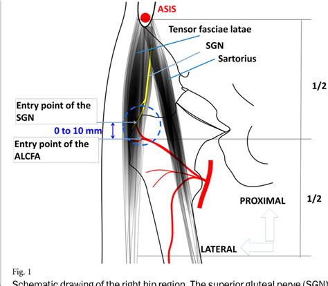 Gluteal Nerve Entrapment