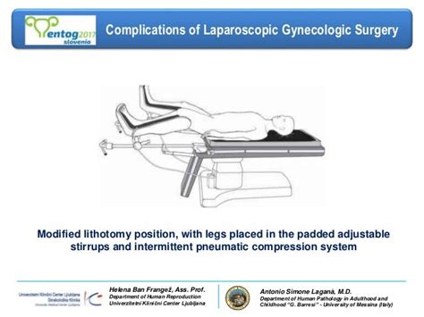 Complications Of Laparoscopic Gynecologic Surgery