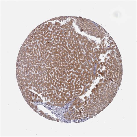 Tissue Expression Of G Pc Staining In Liver The Human Protein Atlas