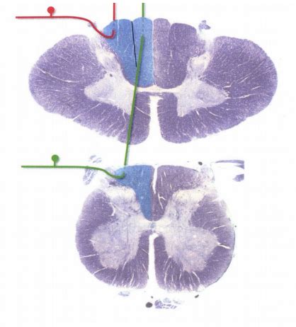 Internal Anatomy Of The Brainstem Flashcards Quizlet