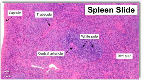 Spleen Slide 400x