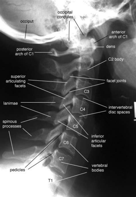 Pin By Kris Lacosta On AnatomÍa RadiolÓgica Radiology Student