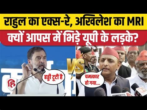 Akhilesh Yadav Said On Rahul Gandhi Caste Census If There Is Mri Ct