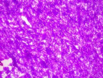 Brain Frontal Lobe Tissue Slides Multiple Sclerosis Frozen NBP2